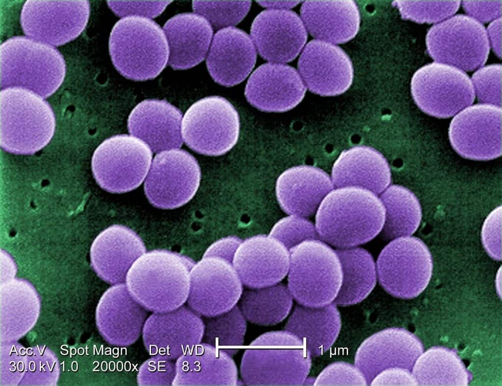 Beard bacteria Staphylococcus aureus